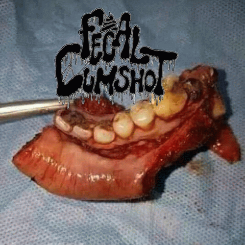 Fecal Cumshot : Strangled by Aa Rotten Cock